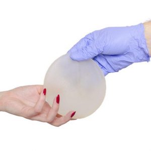 Silikonimplantat